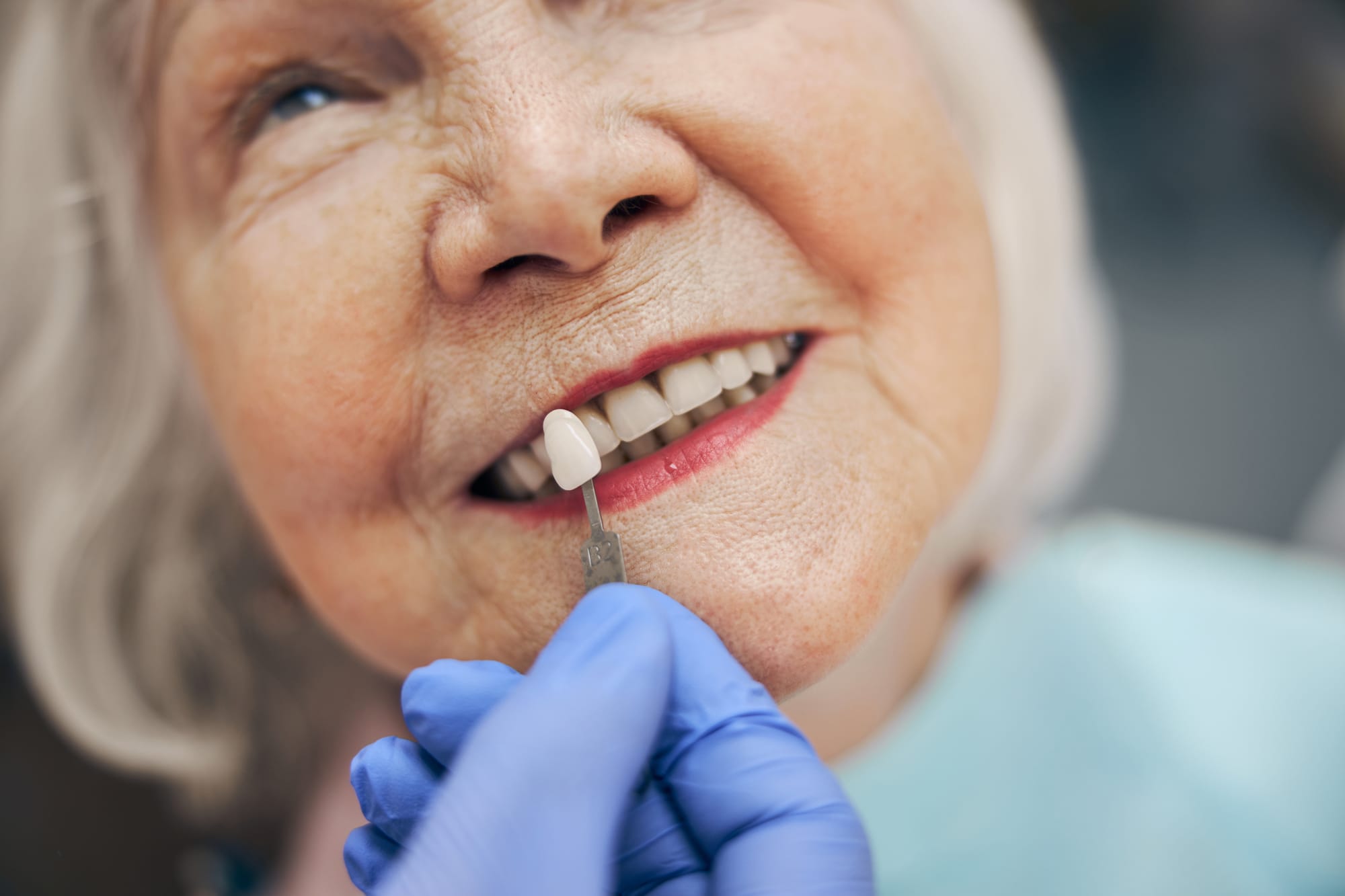 an older woman at the dentist